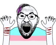 black_nails blood bloodshot_eyes cut emo_hair glasses hair open_mouth painted_nails pale_skin rotten_teeth soyjak stubble suicide tranny trans_flag variant:cirrus // 1214x968 // 32.9KB