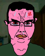 angry black_glasses black_hair bloodshot_eyes clothes ear glasses pink pink_lips pink_skin subvariant:chudjak_front tear trans_tear tshirt variant:chudjak wojak yellow_teeth // 738x908 // 251.2KB