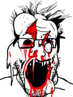 blood blood_from_eyes blood_from_forehead blood_from_mouth blood_on_face body_horror dangling_eye deep_wound deformed exposed_muscle eye_socket eyeball glasses gore hair injury missing_eye mutilation nosebleed open_mouth soyjak stubble variant:markiplier_soyjak white_background // 600x800 // 56.3KB