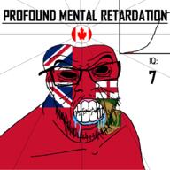 angry bald black_eyes black_hole black_sclera canada clenched_teeth closed_mouth country cracked_teeth drool ear flag flag:canada flag:manitoba glasses iq iq_bell_curve manitoba mustache nightmare_fuel no_pupils profound_mental_retardation retard soyjak stubble text variant:feraljak wrinkles // 1024x1024 // 91.0KB