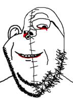 blood blood_from_eyes blood_from_mouth blood_on_face cut looking_to_the_left looking_to_the_right merge scar series:imp_&_gape soyjak stitches stubble variant:gapejak variant:impish_soyak_ears // 598x800 // 60.2KB