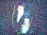 bald epilepsy fur glowing i_have_have_no_clue_what_the_fuck_is_happening incomprehensible multiple_colors nonsense op_may_be_a_mental_patient series:animaljaks squirrel squirreljak tail trend:squirreljakking variant:feraljak // 4200x3100 // 13.9MB