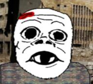 baby blood clothes deformed gore irl_background sad soyjak subvariant:jacobson variant:a24_slowburn_soyjak // 660x599 // 413.2KB