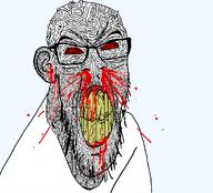 angry blood_from_nose bloodshot_eyes leaking nosebleed overly_detailed_soyjak rage subvariant:feralrage variant:feraljak // 1001x906 // 420.0KB