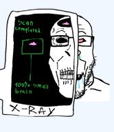 drool greentext retarded skull small_brain variant:markiplier_soyjak variant:retardiplier xray // 800x927 // 204.6KB