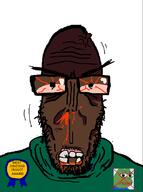 angry badge black_skin bloodshot_eyes eyebrows frog glasses green_shirt hoodie missing_teeth nosebleed pepe stubble subvariant:euromutt variant:markiplier_soyjak // 594x797 // 51.9KB