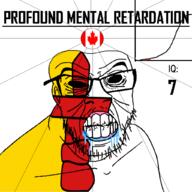 angry bald black_eyes black_hole black_sclera canada clenched_teeth closed_mouth country cracked_teeth drool ear flag flag:canada flag:nunavut glasses iq iq_bell_curve mustache nightmare_fuel no_pupils nunavut profound_mental_retardation retard soyjak stubble text variant:feraljak wrinkles // 1024x1024 // 72.4KB