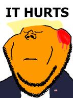 blond blood donald_trump its_over orange_skin text variant:impish_soyak_ears // 479x641 // 85.7KB