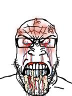 angry bald bloodshot_eyes closed_mouth crying foaming_at_the_mouth glasses nosebleed rage red_face soyjak stubble teeth_showing variant:markiplier_soyjak vein white_background // 600x800 // 195.6KB