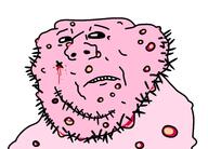acne blood frown gross pink_skin soyjak stubble teeth ugly variant:impish_soyak_ears // 959x688 // 122.9KB