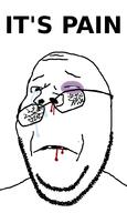 blood broken_glasses broken_teeth closed_mouth crying glasses hurt its_over pain soyjak stubble subvariant:wholesome_soyjak text variant:gapejak wound // 600x1000 // 35.4KB