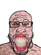 beard bloodshot_eyes disgusting edit fucked_up_teeth glasses meta:op_took_a_selfie_of_xerself meth realistic series:methjaks variant:markiplier_soyjak white_skin // 600x800 // 339.0KB