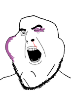 aryan_beast aryan_chad beaten beaten_up black_eyes bleed blood eyes series:fusionjaks stubble subvariant:fuckyniggerpoop subvariant:henry swollen_face variant:cobson variant:impish_soyak_ears weird // 700x933 // 72.0KB