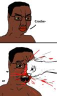 2soyjaks beaten big_lips black_skin blood broken_glasses brown_eyes closed_mouth fist glasses hair hand open_mouth punch racism text variant:chudjak yellow_sclera // 1137x1920 // 126.3KB