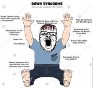 arm brown_hair clothes downs_syndrome foot full_body glasses hand meta:op_took_a_selfie_of_xerself open_mouth retard shutterstock_watermark soyjak stock_image stock_image_watermark stubble text variant:a24_slowburn_soyjak watermark white_skin // 494x469 // 35.2KB