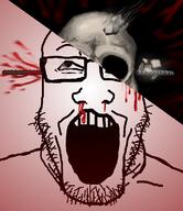 blood broken_glasses damaged final_destination glasses injured pebbles rebar skull variant:markiplier_soyjak // 1035x1200 // 972.9KB