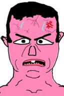 anger_mark bloodshot_eyes buck_teeth ear hair open_mouth pink_skin soyjak subvariant:chudjak_front sweating variant:chudjak vein // 392x590 // 17.7KB