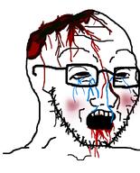 blood blood_on_face bloodshot_eyes blush crying glasses gore guro meta:gore soyjak tear variant:soyak wound // 644x800 // 60.1KB