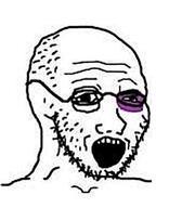 balding beat_up black_eye glasses open_mouth redraw soyjak stubble variant:soyak // 600x684 // 49.3KB