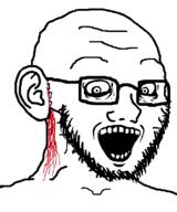 blood blood_drip blood_from_ears crazed ear ear_surgery glasses looking_at_you open_mouth soyjak stitches stubble subvariant:soyak_(crazed) surgery variant:soyak white_background // 665x800 // 10.8KB