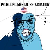 angry bald black_eyes black_hole black_sclera clenched_teeth closed_mouth cracked_teeth drool ear flag flag:minnesota flag:united_states glasses hair iq iq_bell_curve minnesota mustache nightmare_fuel no_pupils profound_mental_retardation retard soyjak star_(symbol) state stubble text united_states variant:feraljak wrinkles // 1024x1024 // 62.9KB
