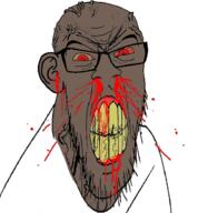 angry black_skin blood bloodshot_eyes clenched_teeth cracked_teeth ear glasses mustache nosebleed red_eyes soyjak stubble subvariant:feralrage variant:feraljak vein yellow_teeth // 894x919 // 393.3KB