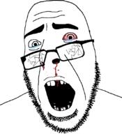 beaten black_eye blood bloodshot_eyes broken_glasses crying glasses missing_teeth open_mouth soyjak stubble variant:cobson // 775x849 // 105.2KB