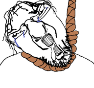 ack crying dumb glasses hair hanging meta:template mick_(namefag) rope subvariant:mickyBRAPcuckhouse template tongue tranny_hair variant:bernd white_skin // 961x900 // 75.0KB