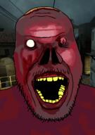 blood half-life half-life_2 half_life_2 no_nose no_pupils pink_skin purple_skin red_skin stubble valve variant:punkjak yellow_teeth zombie // 918x1306 // 452.1KB