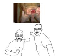 adler_the_Eagle anus butthole clothes ear furfag furry glasses goatse hair meta:pornographic_content pointing stubble variant:two_pointing_soyjaks white_background // 1080x1012 // 328.7KB