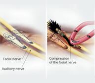 calm diagram glowing hemifacial_spasm label medical medical_diagram nerves schizo seething smile subvariant:schizojak subvariant:wholesome_soyjak variant:gapejak variant:markiplier_soyjak // 773x675 // 465.2KB