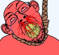 ack angry blood bloodshot_eyes clenched_teeth cracked_teeth crying ear hanging moustache noose nosebleed rage red_eyes red_skin rope rotten_teeth suicide variant:bernd yellow_teeth // 1295x1205 // 68.4KB