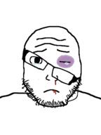 beaten black_eye blood bruise closed_mouth crying frown glasses looking_at_you sad soyjak stubble subvariant:lawrence template variant:markiplier_soyjak // 481x643 // 25.9KB