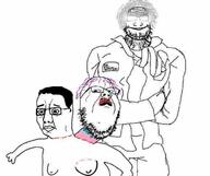 3soyjaks arm clothes doctor glasses grey_hair hair hand mustache necktie purple_hair scared smile soyjak stitches stubble subvariant:dr_soystein surgery tranny variant:chudjak // 663x555 // 19.5KB