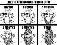 beard closed_mouth ear finasteride glasses hair hairy infographic minoxidil multiple_soyjaks neutral rogaine science soyjak stubble subvariant:neutralplier timeline variant:markiplier_soyjak // 2412x1887 // 247.2KB