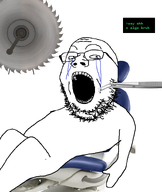 bald braces chair crying dentist english_text gape glasses greentext open_mouth orthodonist saw scared sitting teeth teeth_showing text variant:gapejak white_background // 664x788 // 149.4KB