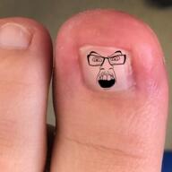 ingrown_toenail toe variant:feraljak // 539x539 // 553.6KB