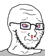 abuse blood blood_on_face crying eyebrows forehead_lines gashes glasses grey_shirt hurt nose nosebleed pain red_eyes scared soyjak stubble variant:soyak violence violent worried // 644x800 // 32.2KB