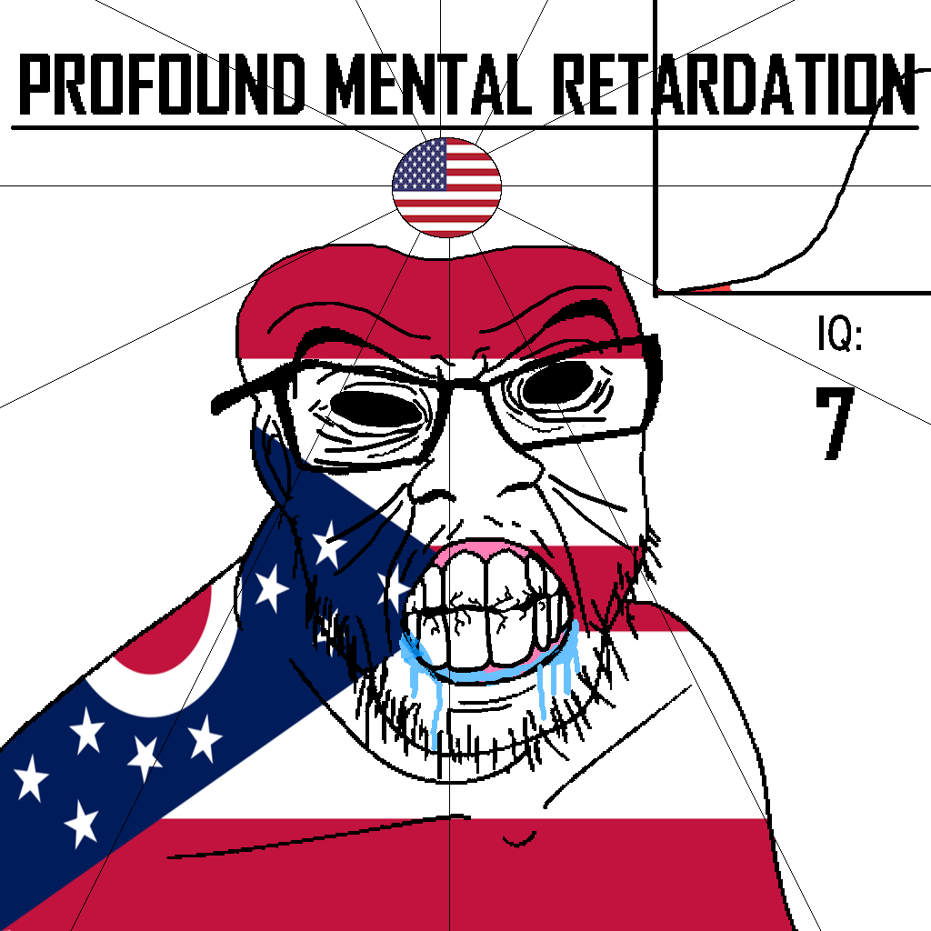 feraljak, angry, bald, black eyes, black hole, black sclera, clenched teeth, closed mouth, cracked teeth, drool