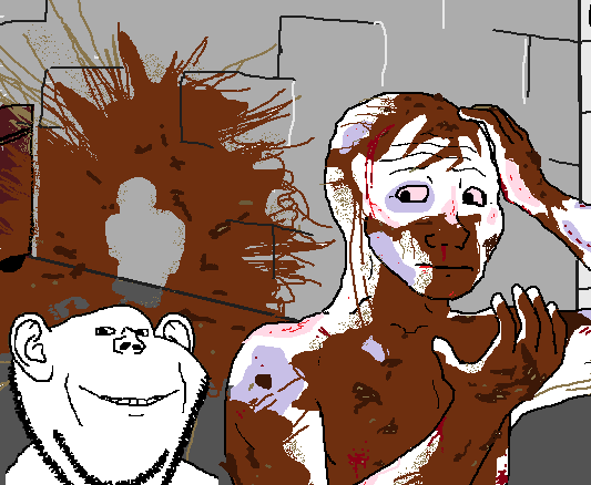 wojak, impish soyak ears, 1nas, 1soyjak, bald, black eyes, blood, blood on face, bruise, chin