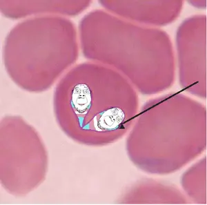 babesia.png