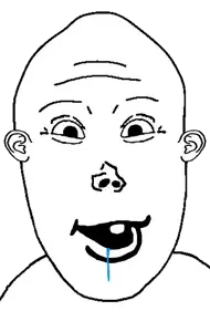 vlodson, brainlet, downs syndrome, dumb, no beard, no glasses, retard, retarded, small brain, stupid