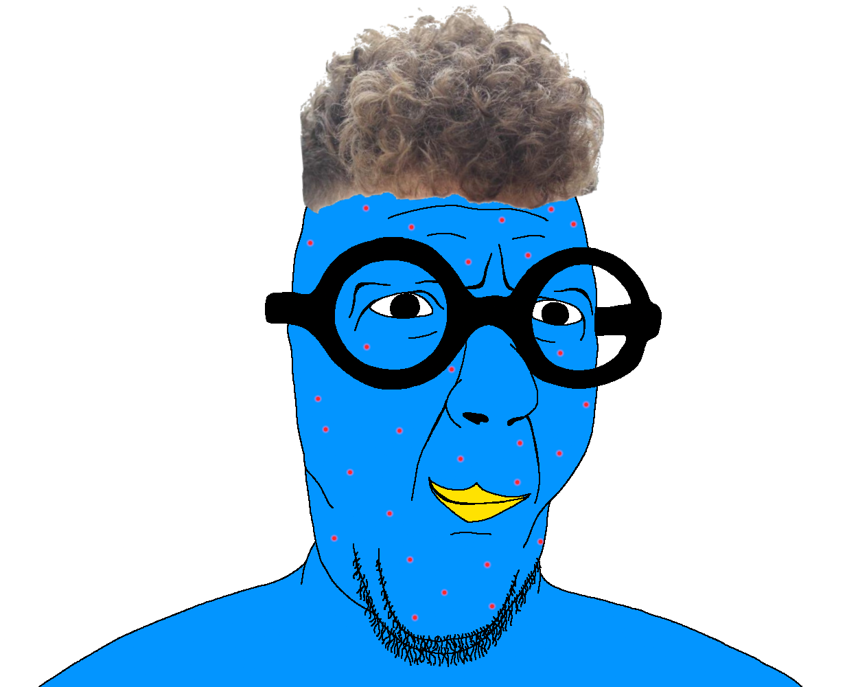 slatejak, x immigrants, acne, animal, beak, beard, big glasses, bird, blue skin, broccoli hair