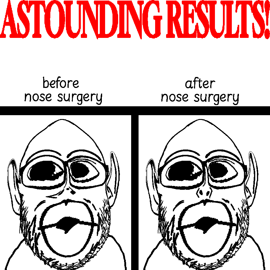 dersoylentdrinker, nojak, nogoblin, before after, big lips, deformed, ear, glasses, lips, looking to the left