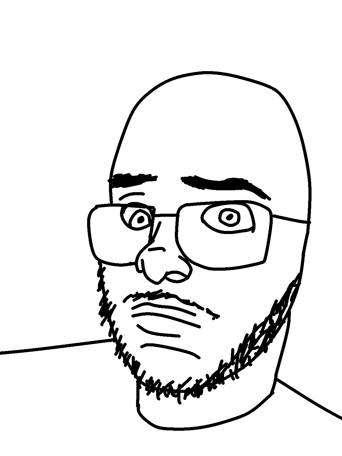 taceboi23, tacejak, unknown, 1soyjak, bald, closed mouth, concerned, cross eyed, glasses, looking at you