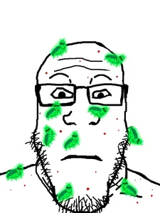 a24 slowburn soyjak, markiplier soyjak, neutralplier, glowie, bug bites, glasses, glowing, neutral, sunglasses