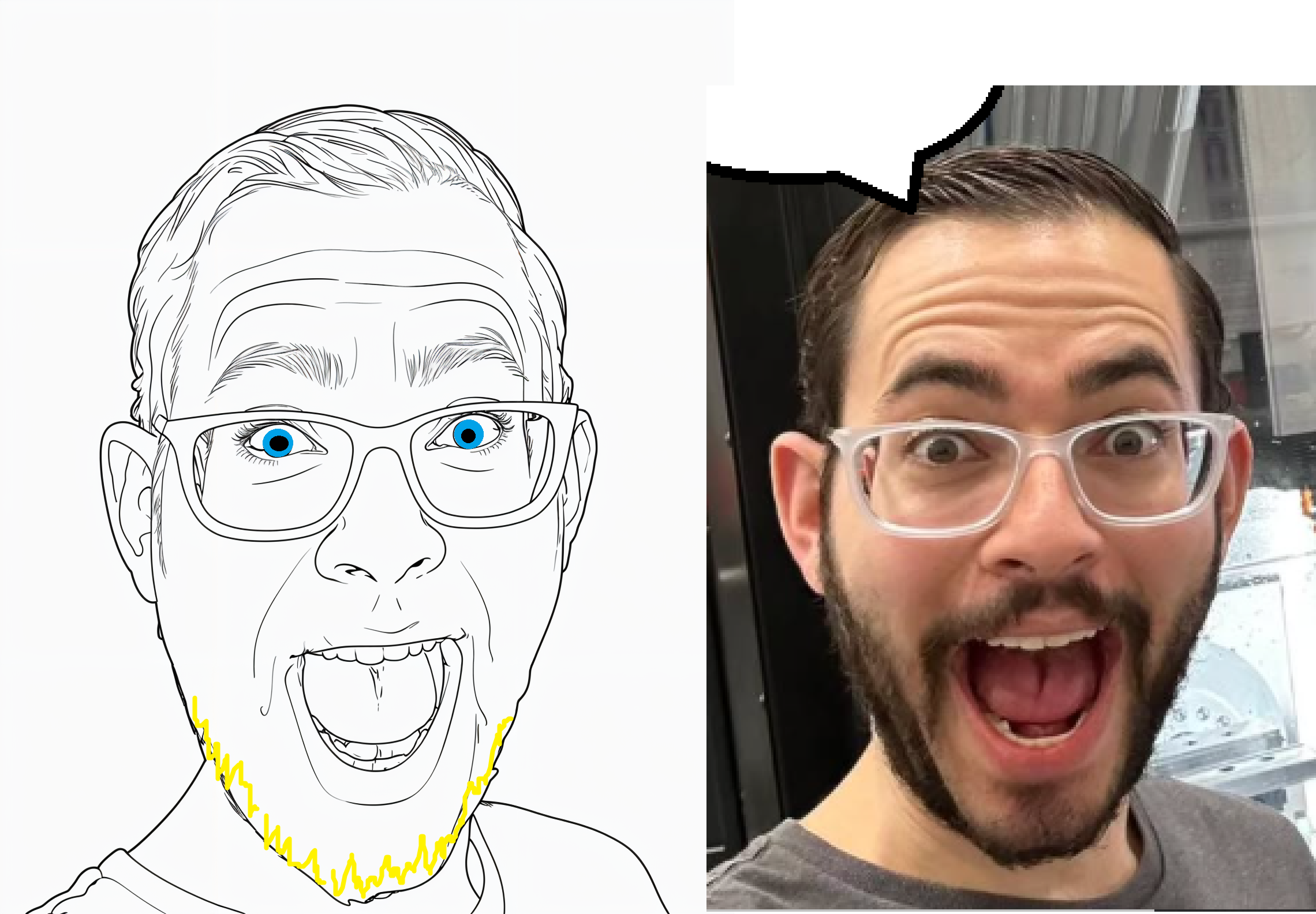 unknown, aryan, a10 eyes, forehead lines, gaping mouth, glasses, hair, open mouth, real life, soyjak mouth wide open