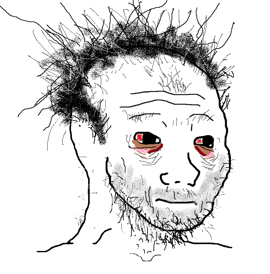 wojak, rotting wojak no background, bloodshot eyes, bruised eye, closed mouth, messy hair, open eyes, stubble, tired, transparent background