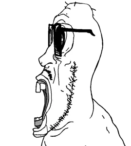 mentaljak side alt.png