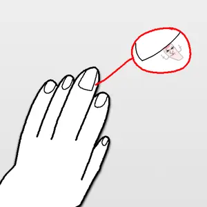 hangnail.png